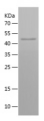 Recombinant Human ACTL6A/人源ACT