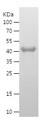 Recombinant Human MEIS3/人源MEIS