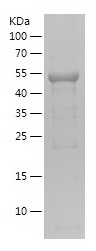 Recombinant Human MDH2/人源MDH2蛋