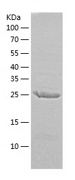Recombinant Human ERCC1/人源ERCC