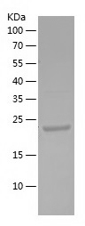 Recombinant Human KRT13/人源KRT1