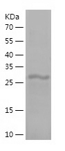 Recombinant Human RPL8/人源RPL8蛋