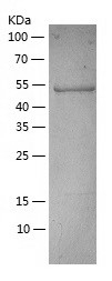 Recombinant Human RUVBL1/人源RUV