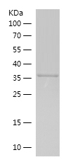 Recombinant Human RB1CC1/人源RB1