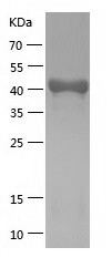 Recombinant Human PAFAH2/人源PAF