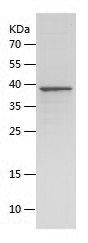 Recombinant Human TOP2A/人源TOP2