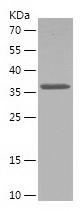 Recombinant Human AP1G1/人源AP1G