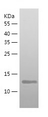 Recombinant Human KMT5A/人源KMT5