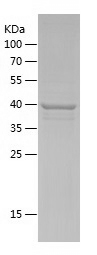 Recombinant Human TMEM168/人源TM