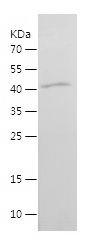 Recombinant Human RAB18/人源RAB1