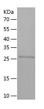 Recombinant Human ZNF346/人源ZNF