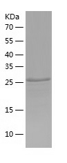Recombinant Human ZNF699/人源ZNF