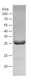 Recombinant Human DHRS4/人源DHRS