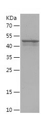 Recombinant Human RRM2/人源RRM2蛋