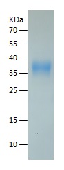 Recombinant Human CD16a/人源CD16