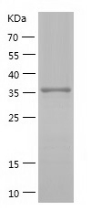 Recombinant Human NCK2/人源NCK2蛋