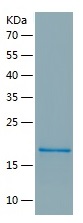 Recombinant Human MBL2/人源MBL2蛋