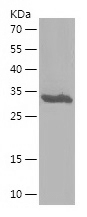 Recombinant Human ATP5ME/人源ATP