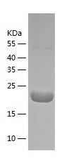 Recombinant Human Ube2G2/人源Ube
