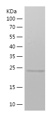 Recombinant Human METTL4/人源MET