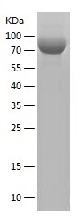 Recombinant Human Mesothelin/人