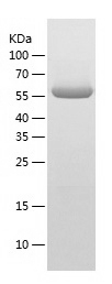 Recombinant Human OXSR1/人源OXSR