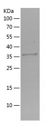 Recombinant Human CTHRC1/人源CTH