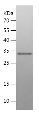 Recombinant Human S100B/人源S100