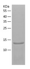 Recombinant Human SH2D1A/人源SH2