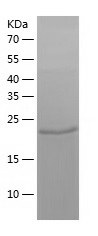 Recombinant Human ZNF266/人源ZNF