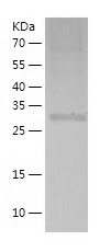 Recombinant Human MRPS2/人源MRPS