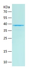 Recombinant Human HTRA4/人源HTRA