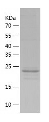 Recombinant Human OTUB2/人源OTUB