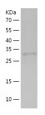 Recombinant Human CCDC69/人源CCD