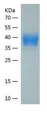 Recombinant Human Mesothelin/人