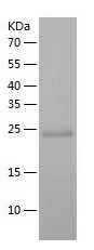 Recombinant Human DGCR6L/人源DGC