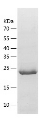 Recombinant Human ANKRD50/人源AN