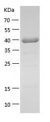 Recombinant Human MAPK14/人源MAP