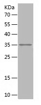 Recombinant Human TET2/人源TET2蛋