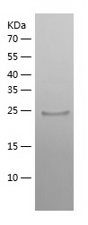 Recombinant Human ZNF10/人源ZNF1
