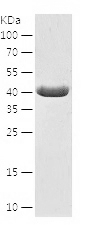 Recombinant Human CALCOCO2/人源C