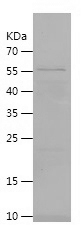 Recombinant Human DNASE1L3/人源D
