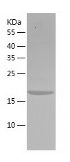 Recombinant Human NMRK1/人源NMRK