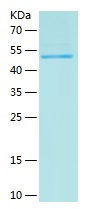 Recombinant Human SNRPA1/人源SNR