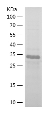 Recombinant Human CDKN1B/人源CDK