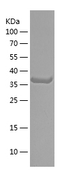 Recombinant Human NTNG1/人源NTNG