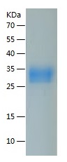 Recombinant Human CD32a/人源CD32