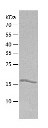 Recombinant Human GUK1/人源GUK1蛋