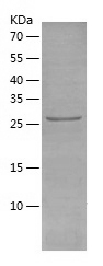 Recombinant Human PGAM2/人源PGAM