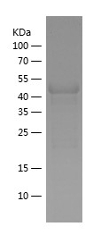 Recombinant Human PIAS4/人源PIAS